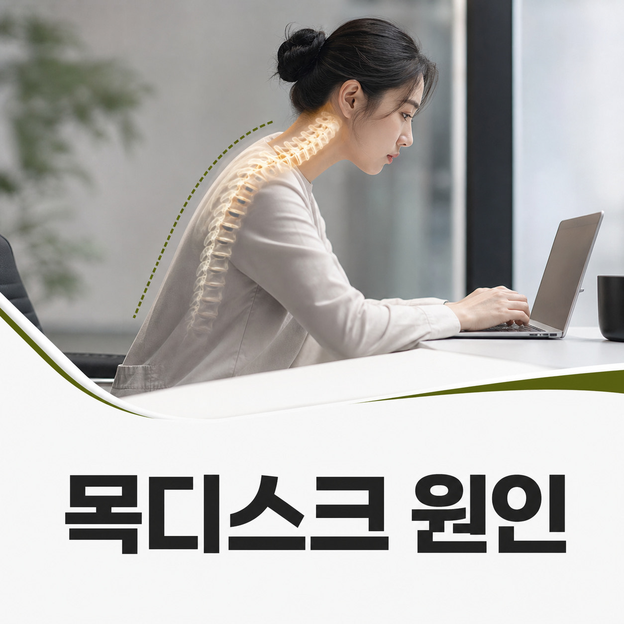 목디스크 원인과 진단